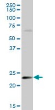 Anti-HSPB8 antibody produced in mouse purified immunoglobulin, buffered aqueous solution