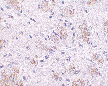 Anti-KLHL1 antibody produced in rabbit affinity isolated antibody, buffered aqueous solution