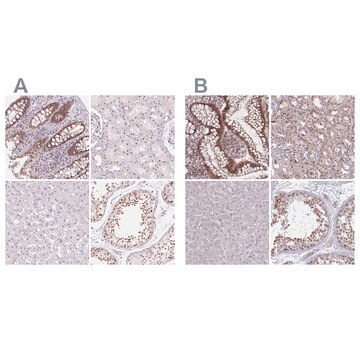 Anti-ZC3H14 antibody produced in rabbit Prestige Antibodies&#174; Powered by Atlas Antibodies, affinity isolated antibody, buffered aqueous glycerol solution