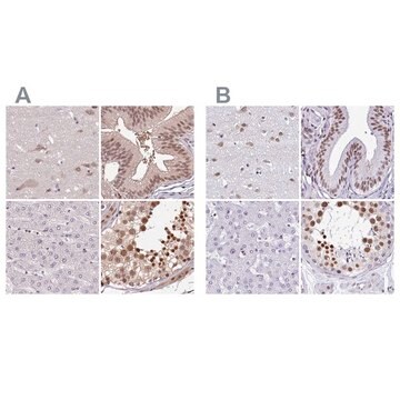 Anti-DR1 antibody produced in rabbit Prestige Antibodies&#174; Powered by Atlas Antibodies, affinity isolated antibody, buffered aqueous glycerol solution