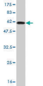 Monoclonal Anti-RLBP1 antibody produced in mouse clone 1H7, purified immunoglobulin, buffered aqueous solution