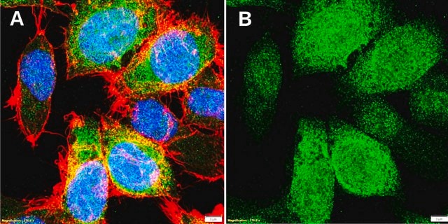 Anti-Cyclin B1 Antibody, clone V152, ZooMAb&#174; Mouse Monoclonal recombinant, expressed in HEK 293 cells