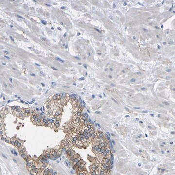 Anti-CMTM1 antibody produced in rabbit Prestige Antibodies&#174; Powered by Atlas Antibodies, affinity isolated antibody, buffered aqueous glycerol solution