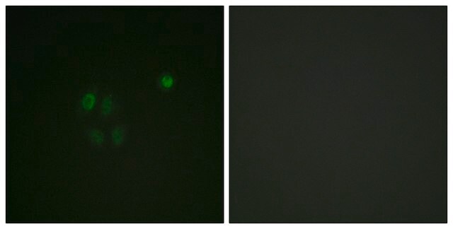 Anti-CHK1 antibody produced in rabbit affinity isolated antibody