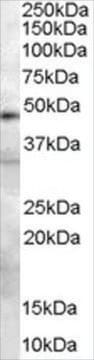 Anti-Plasminogen Activator/PLAU antibody produced in goat affinity isolated antibody, buffered aqueous solution