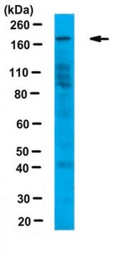 Anti-JARID1C Antibody from rabbit