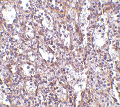 Anti-STIM1 antibody produced in rabbit affinity isolated antibody, buffered aqueous solution