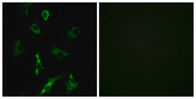 Anti-OR5B3 antibody produced in rabbit affinity isolated antibody