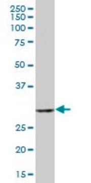 Anti-TBCB antibody produced in mouse IgG fraction of antiserum, buffered aqueous solution