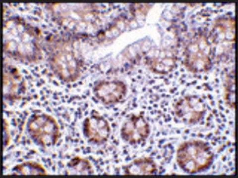 Anti-LSD1 antibody produced in rabbit affinity isolated antibody