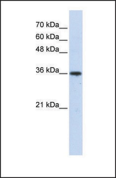 Anti-AKR7A3 antibody produced in rabbit affinity isolated antibody