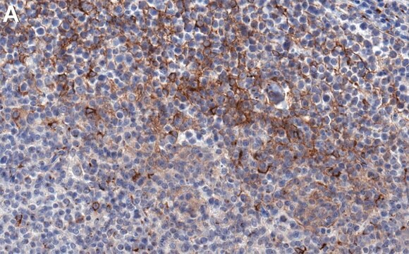 Anti-TGFBR2 Antibody, clone 1N11 ZooMAb&#174; Rabbit Monoclonal recombinant, expressed in HEK 293 cells