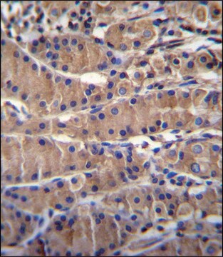 ANTI-TEKT5 (CENTER) antibody produced in rabbit IgG fraction of antiserum, buffered aqueous solution