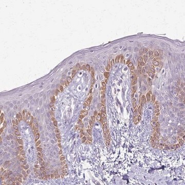 Anti-SLC35E2 antibody produced in rabbit Prestige Antibodies&#174; Powered by Atlas Antibodies, affinity isolated antibody, buffered aqueous glycerol solution