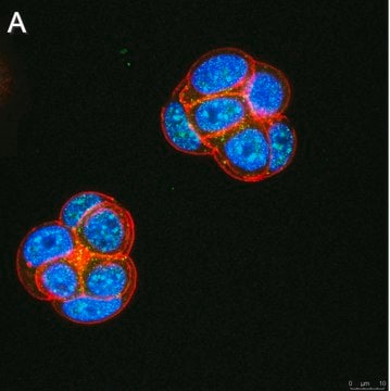 Anti-Ubiquilin 4 Antibody, clone 5K6 ZooMAb&#174; Rabbit Monoclonal recombinant, expressed in HEK 293 cells