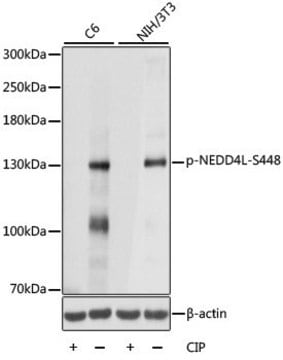 Anti-Phospho-NEDD4L-S448 antibody produced in rabbit