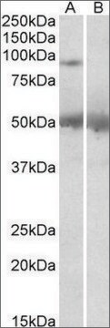 Anti-USP6 (C-terminal) antibody produced in goat affinity isolated antibody, buffered aqueous solution