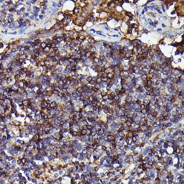 Anti-Human IgM Antibody, clone 6F7T2, Rabbit Monoclonal