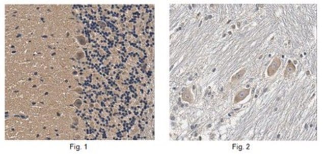 Anti-CLN3 Antibody, Clone 2B8.2 clone 2B8.2, from mouse