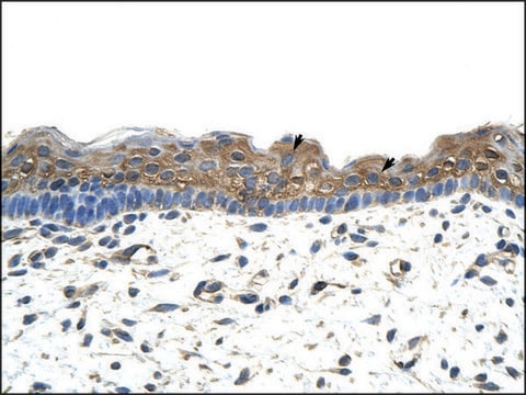 Anti-APOBEC2 antibody produced in rabbit IgG fraction of antiserum