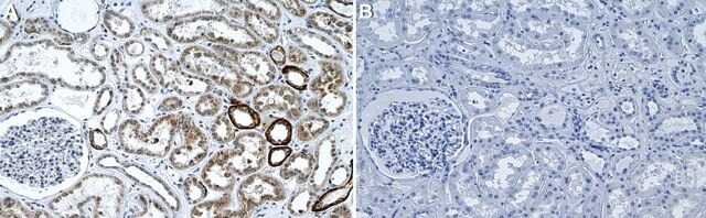 Anti-TCF21 Antibody, clone 2H11 ZooMAb&#174; Rabbit Monoclonal recombinant, expressed in HEK 293 cells