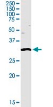 Anti-TREX1 antibody produced in rabbit purified immunoglobulin, buffered aqueous solution