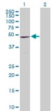 Anti-CCR9 antibody produced in rabbit purified immunoglobulin, buffered aqueous solution