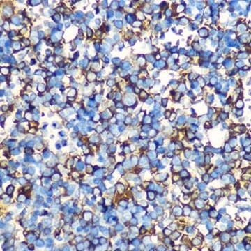 Anti-Alpha-Fetoprotein (AFP) antibody produced in mouse