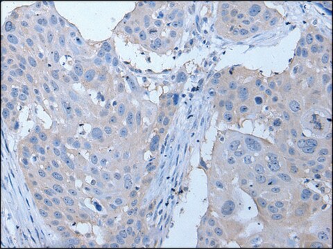 Anti-YPEL4 affinity isolated antibody