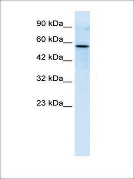 Anti-RIPX antibody produced in rabbit affinity isolated antibody