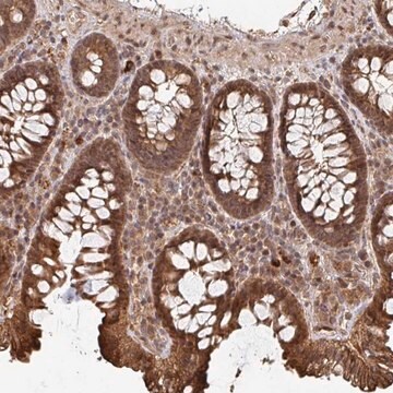 Anti-OR4C15 antibody produced in rabbit Prestige Antibodies&#174; Powered by Atlas Antibodies, affinity isolated antibody, buffered aqueous glycerol solution