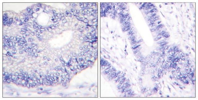 Anti-TGF &#945; antibody produced in rabbit affinity isolated antibody