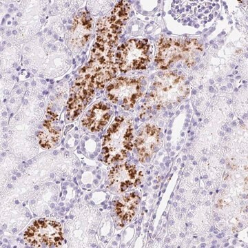 Anti-TMEM200B antibody produced in rabbit Prestige Antibodies&#174; Powered by Atlas Antibodies, affinity isolated antibody, buffered aqueous glycerol solution