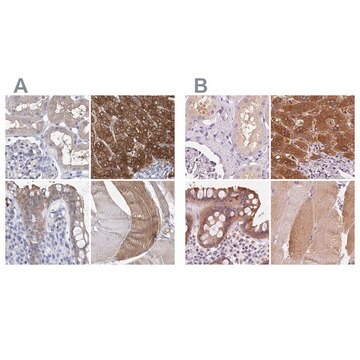 Anti-UGP2 antibody produced in rabbit Prestige Antibodies&#174; Powered by Atlas Antibodies, affinity isolated antibody, buffered aqueous glycerol solution