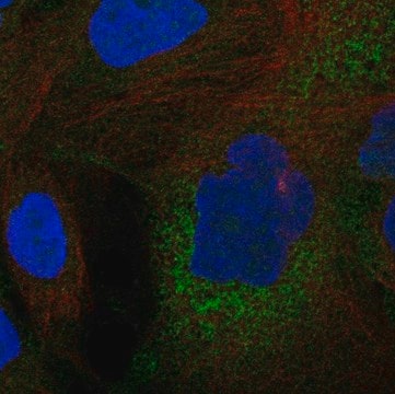 Anti-C11Orf16 Antibody Produced In Rabbit Prestige Antibodies&#174; Powered by Atlas Antibodies, affinity isolated antibody, buffered aqueous glycerol solution