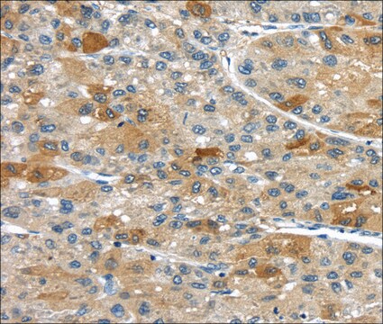 Anti-UPP2 affinity isolated antibody