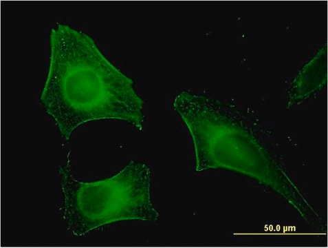 Monoclonal Anti-FEM1B antibody produced in mouse clone 4B12, purified immunoglobulin, buffered aqueous solution