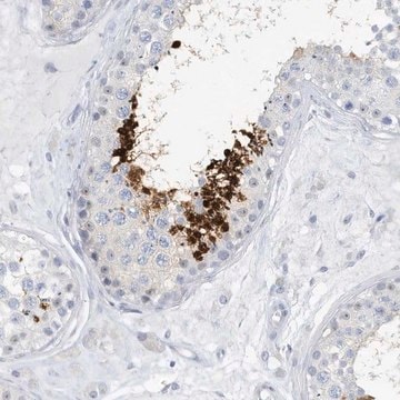 Anti-GSE1 antibody produced in rabbit Prestige Antibodies&#174; Powered by Atlas Antibodies, affinity isolated antibody, buffered aqueous glycerol solution