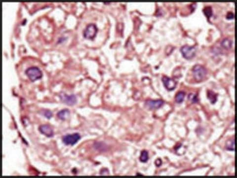 Anti-TGFBR1 (center) antibody produced in rabbit IgG fraction of antiserum, buffered aqueous solution