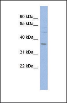 Anti-HMGCLL1, (N-terminal) antibody produced in rabbit affinity isolated antibody