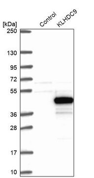 Anti-KLHDC9 antibody produced in rabbit Prestige Antibodies&#174; Powered by Atlas Antibodies, affinity isolated antibody, buffered aqueous glycerol solution