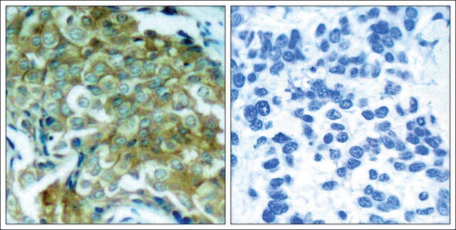 Anti-phospho-EGFR (pTyr1172) antibody produced in rabbit affinity isolated antibody