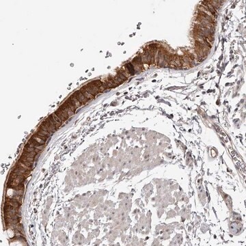 Anti-ZNF582 antibody produced in rabbit Prestige Antibodies&#174; Powered by Atlas Antibodies, affinity isolated antibody, buffered aqueous glycerol solution