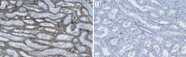 Anti-Collagen IV &#945;2 Antibody, clone 1D9 ZooMAb&#174; Rabbit Monoclonal recombinant, expressed in HEK 293 cells