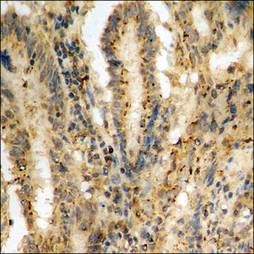 Anti-phospho-IkappaB-&#945; (pSer32/36) antibody produced in rabbit affinity isolated antibody