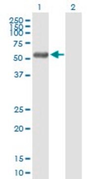 Anti-RCBTB2 antibody produced in mouse purified immunoglobulin, buffered aqueous solution