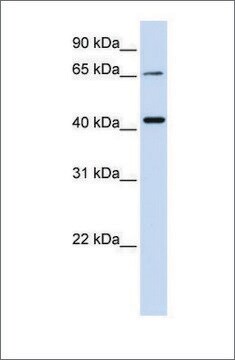 Anti-QPCTL antibody produced in rabbit affinity isolated antibody