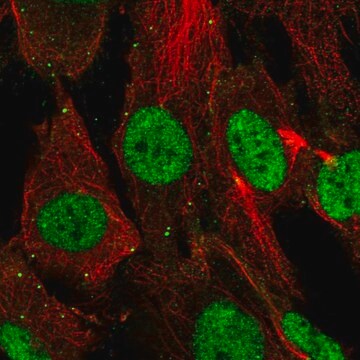 Anti-SHOX antibody produced in rabbit Prestige Antibodies&#174; Powered by Atlas Antibodies, affinity isolated antibody