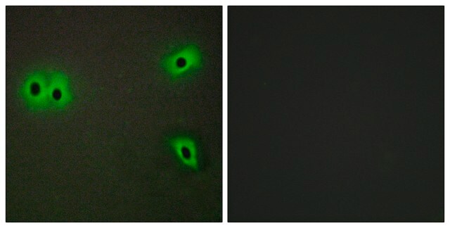 Anti-Collagen XIII &#945;1 antibody produced in rabbit affinity isolated antibody