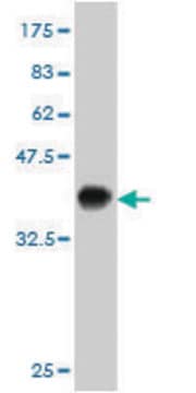 ANTI-KIT antibody produced in mouse clone 5A11, purified immunoglobulin, buffered aqueous solution